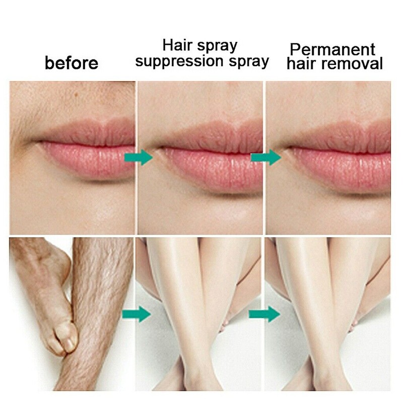 Extra Strong Permanent Hair Removal Spray Stop Hair Growth Inhibitor