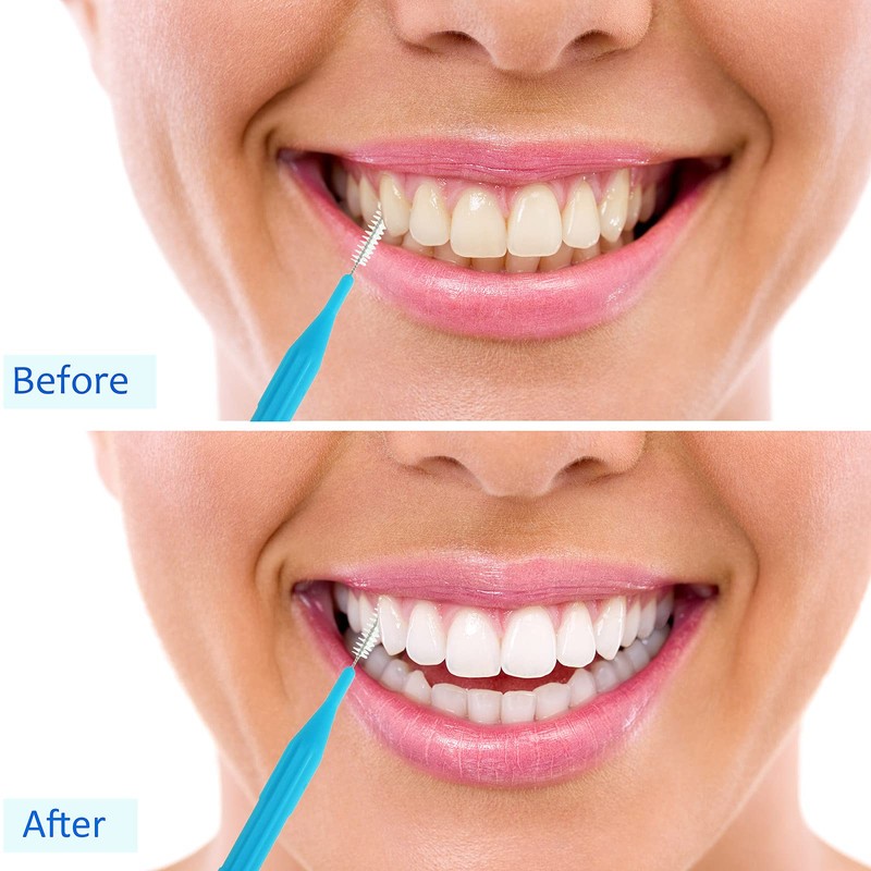 100 piezas de cepillos para limpiador, cepillo interdental, palillo de