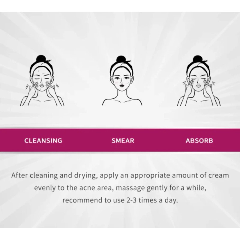 RtopR 3 Cream For Fading Acne Scars Smooth Clear Dark