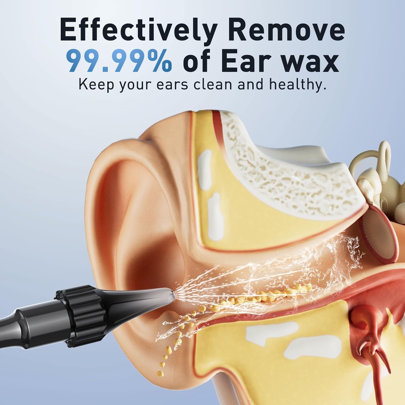Lebbtl Ear Wax Removal - Electric Ear Irrigation Flushing System,