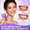 Teeth Whitening Strips Purple 28 Strips - Gentle & Effective