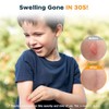 YARKOR Bug Bite Suction Tool, Natural Itch Relief & Swelling