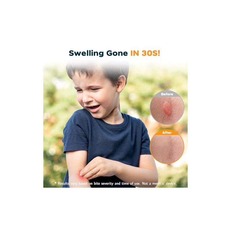 YARKOR Bug Bite Suction Tool, Natural Itch Relief & Swelling