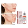 Sérum Facial Jaysuing Antiacné Niacinamida 5% 30ml Rostro