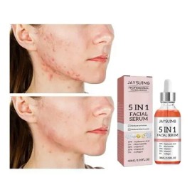 Sérum Facial Jaysuing Antiacné Niacinamida 5% 30ml Rostro