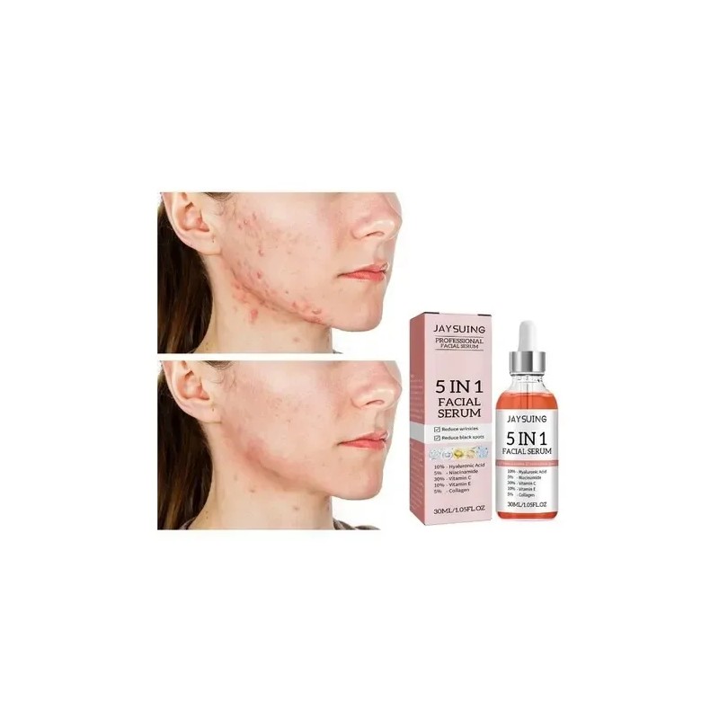 Sérum Facial Jaysuing Antiacné Niacinamida 5% 30ml Rostro