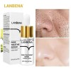 Lanbena Sérum Tratamiento Anti Poros Puntos Negros Y Acné