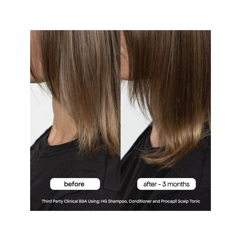 Bondi Boost Hair Growth Conditioner 300ml