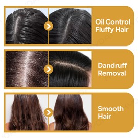 KYDA 3 Pcs Ginger Hair Shampoo Bar for Hair Growth, Deep Cleaning and Nourishing Scalp with Turmeric Powder and Ginger Oil, Moisturizing and Oil Control Dry Hair, Turmeric Shampoo Bar