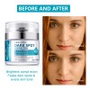 Crema Facial Aclara Manchas Despigmentante Corrector 50ml