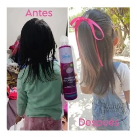 Kit Capilar Shampoo De Cebolla Suero Capilar Y Mascarilla
