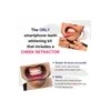 Kit Profesional De Blanqueamiento Dental, Luz Led Acelerador