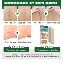 Wundheilpflaster (10 Pflaster, 4 x 15 cm), zur Reduzierung von Narben, professionelle medizinische Silikonplatten, reduziert und verhindert hypertrophe oder cheloide Narben, Verbrennungen und Schnitte