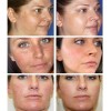 Crema Quitamanchas Hidratante 20g Para Rostro Todo Tipo De Piel