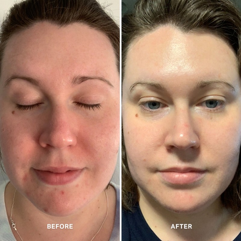 Alpha-H Vitamin A Serum with 0.5% Retinol 10mL