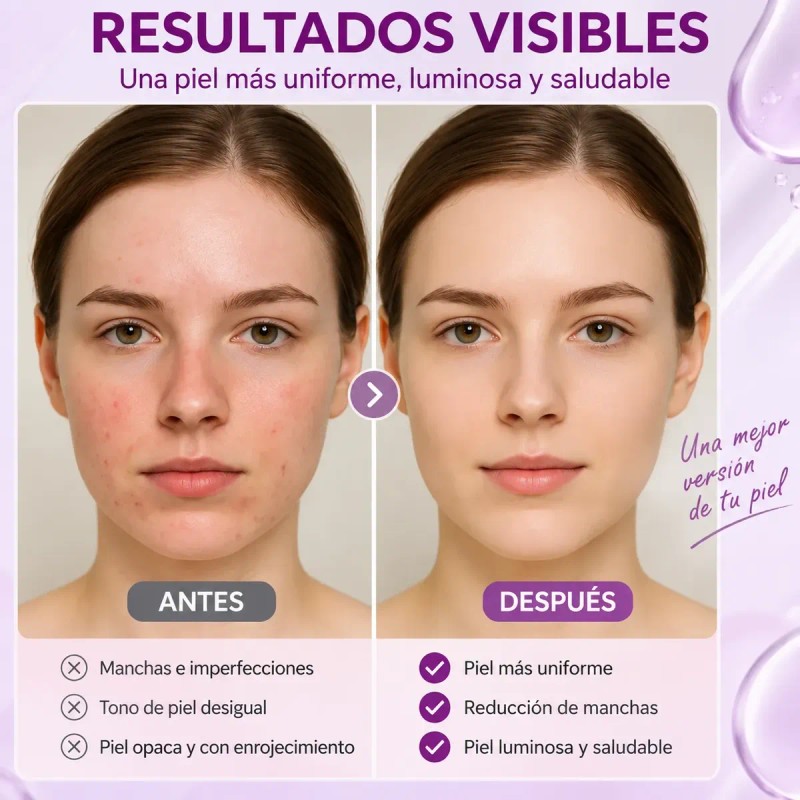 Serum Antimanchas Niacinamida 20% Todo Tipo De Piel 40ml