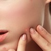 뾰족피지핀셋 초등학생블랙헤드 귀블랙헤드제거 겨드랑이피지제거 Sharp Pimple Tweezers for Elementary School