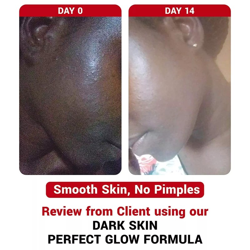 A3 Lemon Face Cream | Brightening & Control Stubborn Blemishes|400