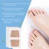 144PCS Extra Strength Fungal Nail Patches for Toenail Fungus, Tea