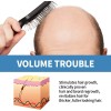 Unbranded Re:act Minoxi Roll-on Hair Treatment Hair Growth Serum Hair