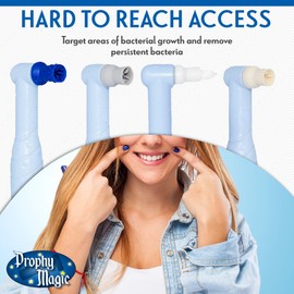 ProphyConeTM by ProphyMagic, E-Type for Removable Nose Cone Motors Only, Better Flaring for Seamless Subgingival Access, Ribbed Cups to Reduce Splatter, No Need for Nose Cones, Firm