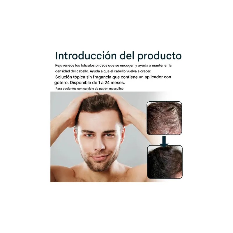 Esencia Anticaída Para El Cuidado Del Cabello Masculino-3pcs