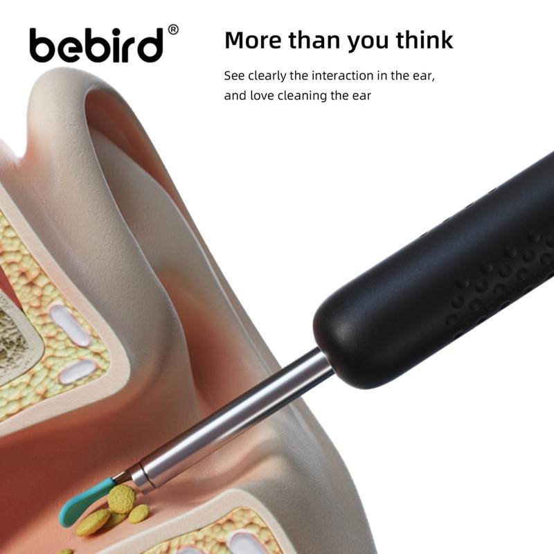 bebird Earpicks Ear Wax Removal Tools with LED Light Visual