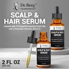 Dr. Berg Scalp & Hair Serum (Improved Formula) with Vitamin