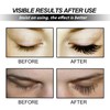 Eyelash Growth Serum For Stronger – Lash Serum For Thicker,