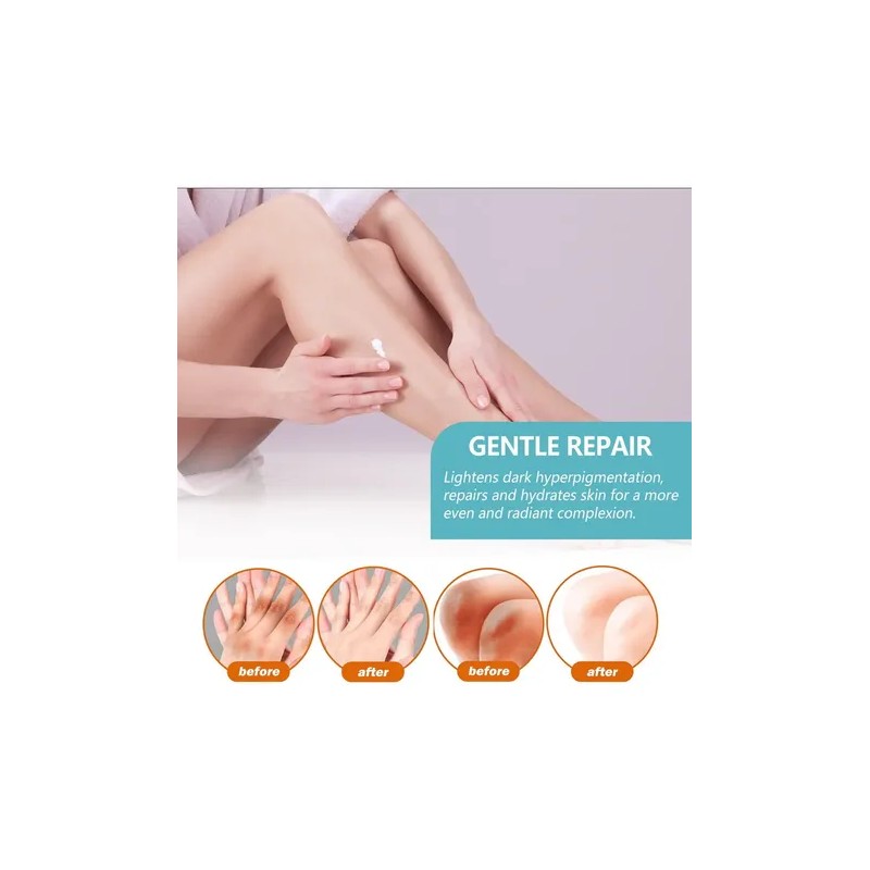 Crema 3× Para Acantosis Nigricans Fbg 50g