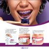 Kontrol Toothpaste Violet Bleach - Colour Correction Serum 30ml for