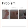 Detachable Washable Foot File USB Waterproof Callus Remove Rechargeable Foot
