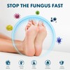 Tea Tree Oil Foot Spray for Dry, Cracked Heels –
