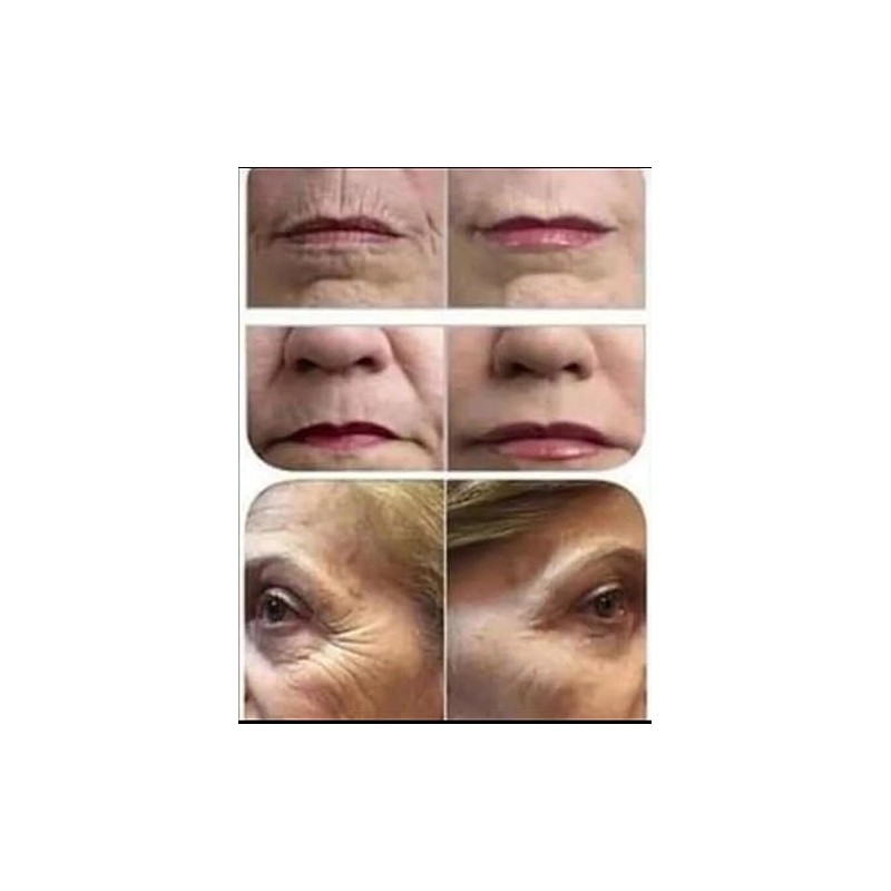 Acido Hialuronico y Vitamina C Suero antiedad Artistry