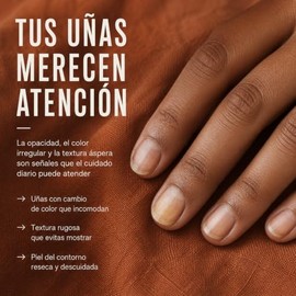 Crema Para Uñas Perfect Nail - Beauty Freedom - 100g - Con Aceite de Romero y Orégano, Tea Tree, Tomillo, Jojoba, Vitamina E Y Acido Lactico - Hidrata