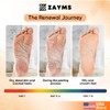 ZAYMS Foot Peeling Mask 5 Pack - Exfoliating Mask for
