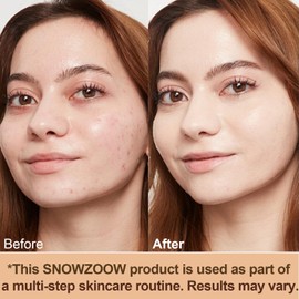 Snowzoom Forever 4-in-1 Makeup Foundation SPF 50+ – Full Coverage, Color Adaptive, Hydrating & Long-Lasting for Sensitive Skin, Medium to Light Shade (Medium Spectrum, 1.2 oz)