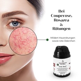 Mixedskins Organic Anti-Red Rosacea Facial Care with Anti-Aging Effect. Cream for facial redness, itching, and pimples. Natural cosmetic facial cream.