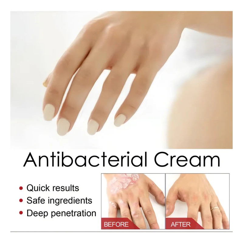 Pomada Herbal Antibacterial para Cuidado de la Piel Sensible Irritación,
