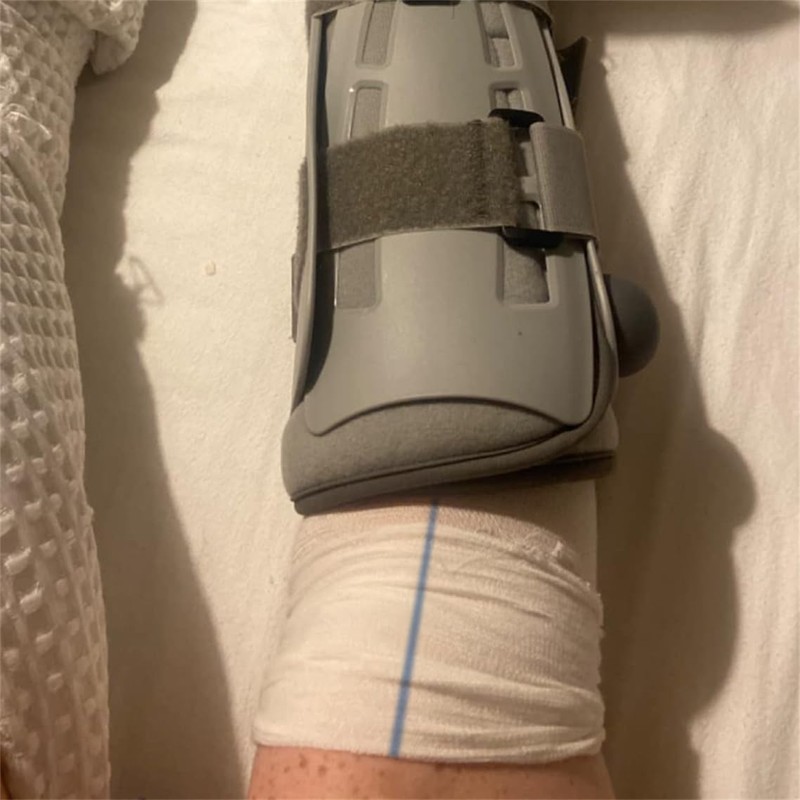 Tubular Bandage Cast Sleeve Roll Comfortable Cast Stockinette Tubular Arm