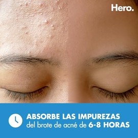 Hero Parches para Acné Mighty Patch Invisible+, Caja con 36 piezas. Delgados para Uso de Día. Absorben Gentilmente las Impurezas en 6 a 8 Horas. No Contienen Medicamento. Probados Dermatológicamente