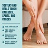 AmLactin Foot Repair Cream - Therapeutic Foot Cream for Dry