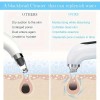 Unbranded Blackhead Remover Vacuum - 6 Attachments, 3 Suction Levels,