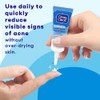 Clean & Clear Advantage Acne Spot Treatment, Unisex, 0.75 oz