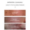 JOMTAM Amino Acid Cleansing Facial Anti-Acne Essence Moisturizing Removed Mites