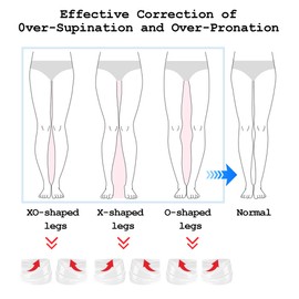 Overpronation Insoles,Adjustable 3-Layer Heel Wedge Insoles for Overpronation and Supination Correction, Orthotic Inserts for Men and Women with Xo Leg Shape (Large)