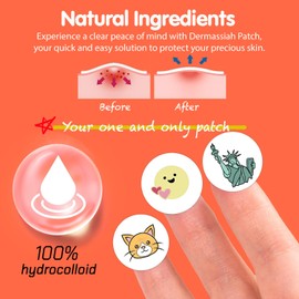 EMO PATCH Acne Pimple Patches for Face 54 Count with Mirror Case for Day & Night Use - Hydrocolloid Pimple Pads, Emoji-Themed Blemish Dots, Clear Skin Treatment (Emoji)