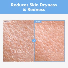 NATUREKIND Deer Panthenol Cream 5.1 fl oz (150 ml), CICA Deer, Panthenol, Face Cream, Moisturizing Care, Rough Skin, Sensitive Skin, Dry Skin, Korean Skin Care Cosmetics