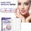 288pcs Dark Spot Removal Blemish Patches with Vitamin C &