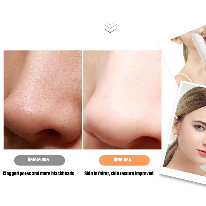 Small Bubble Pore Cleaner 3 Gears Electric Remove Blackhead Face